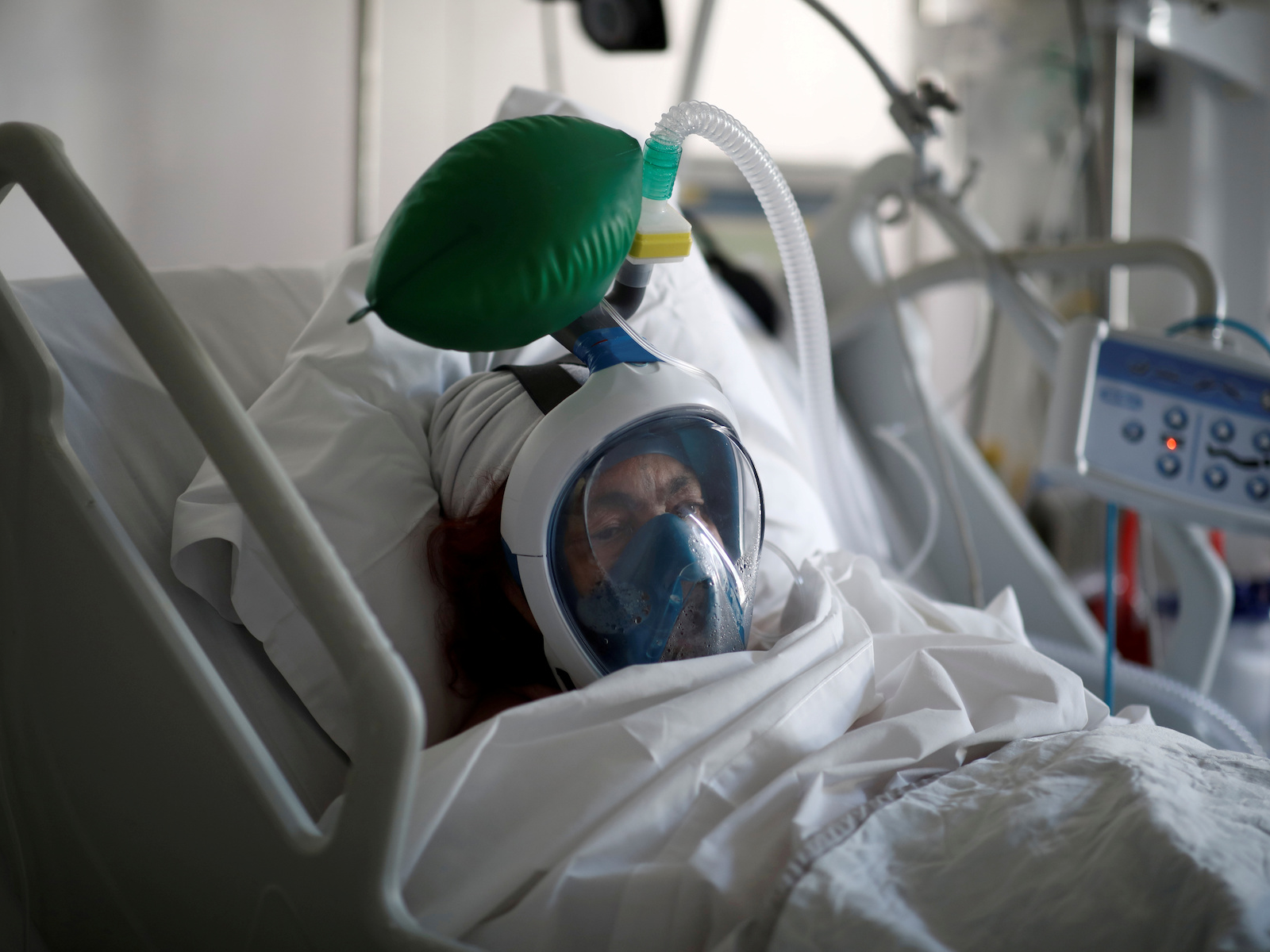 Read more about the article 80% of patients die in ICU – Fulcrumy Health Tip