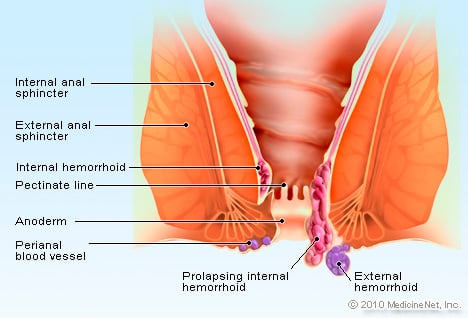 Read more about the article Anal pain, bleeding, rectal swelling, infallible tips to get rid of inflammation