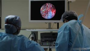 Read more about the article Aspergillosis after black fungus, new disease spreading panic – Kolkata24x7