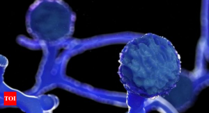 Read more about the article Black Fungus in Chittaranjan!  Refer patient from district hospital to Bankura Medical