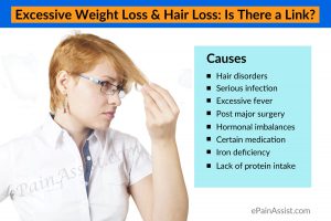 Read more about the article Causes of Excessive Hair Loss – Fulcrumy Health Tip