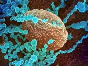 Read more about the article Corona Delta Plus species cause new concern in India!  Vaccines will not be able to stop