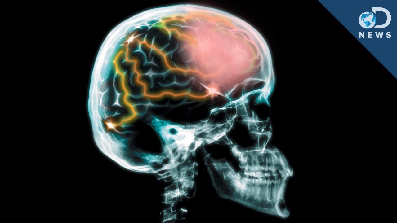 You are currently viewing Do we really use only 10% of our brain?