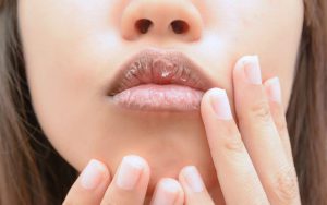 Read more about the article Do you suffer from chapped lips all year round?  Know the solution