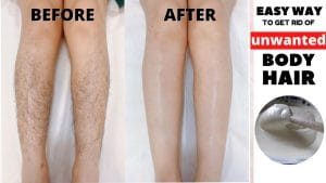 Read more about the article Easy Way To Get Rid Of Dark Spots Under Eyes – Fulcrumy Health Tip