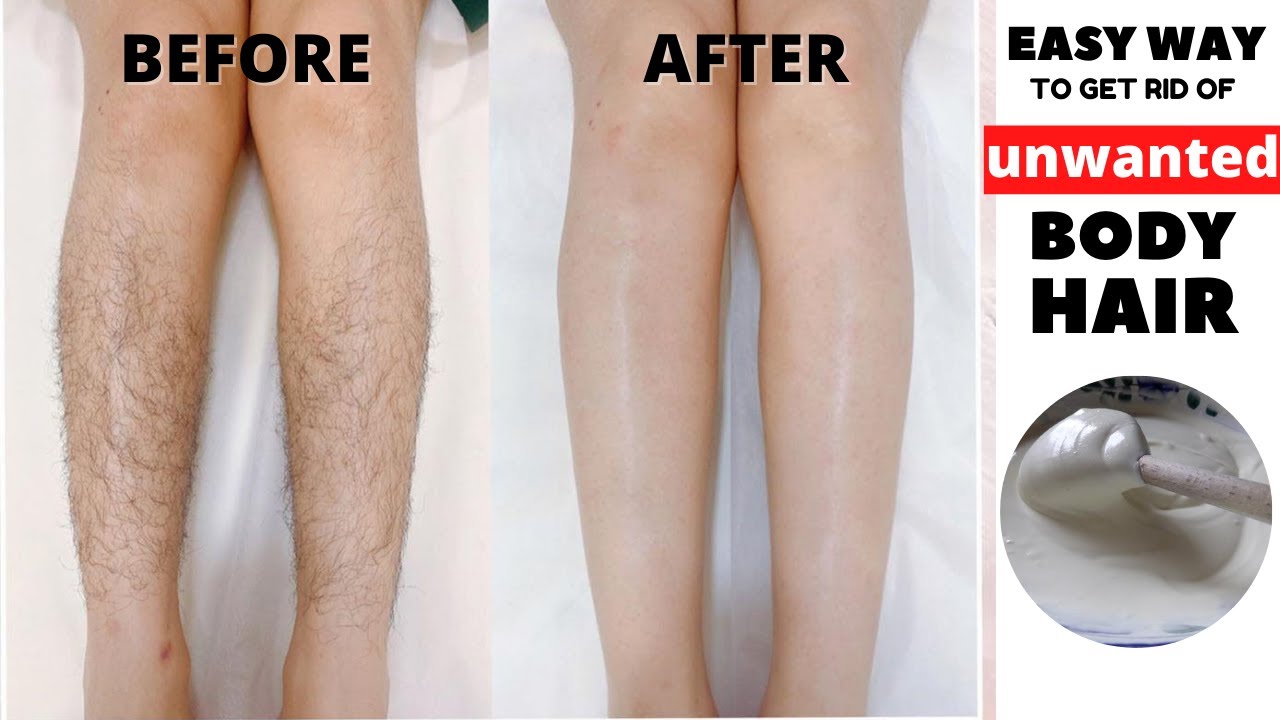 You are currently viewing Easy Way To Get Rid Of Dark Spots Under Eyes – Fulcrumy Health Tip