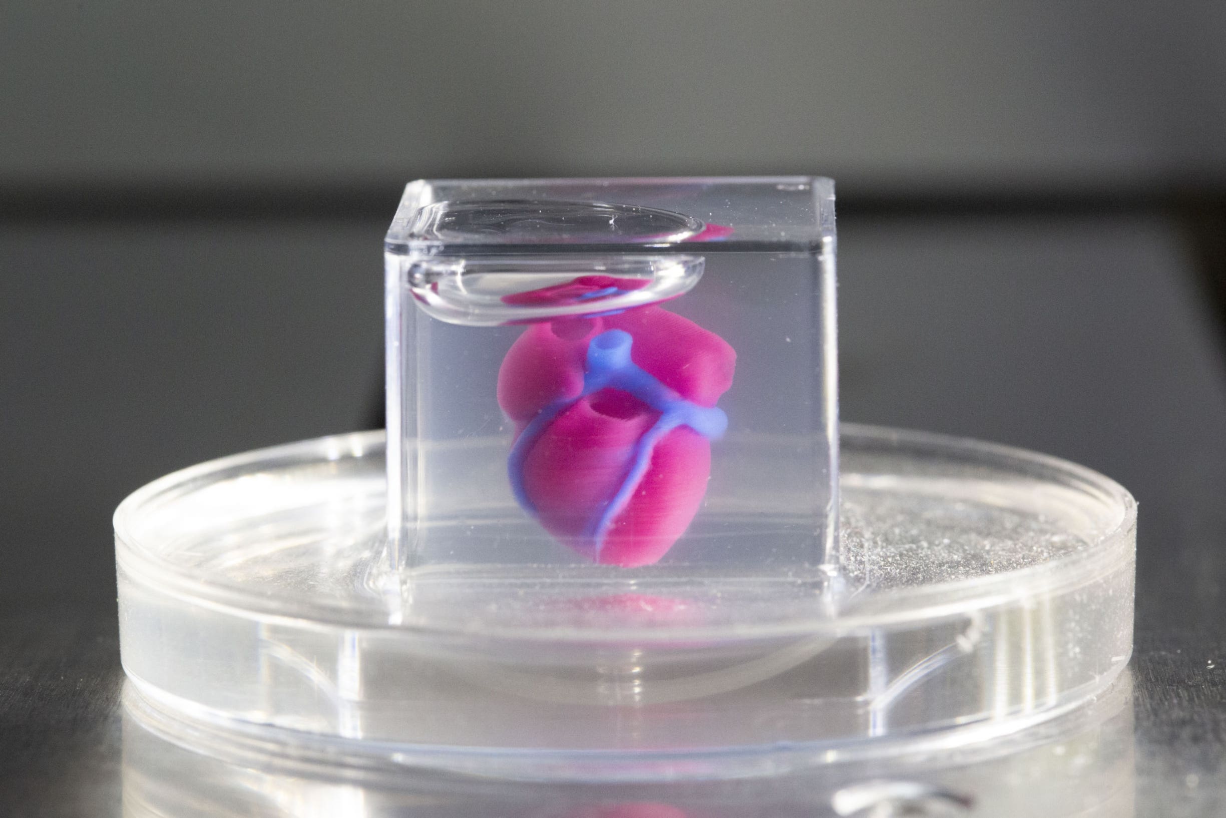 You are currently viewing Hearts built into 3D printers helped save a child’s life