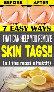 Read more about the article Here are 7 easy ways to show yourself slim – Fulcrumy Health Tip