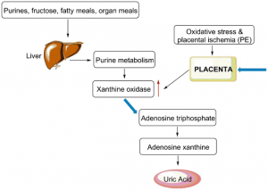 Read more about the article Increased uric acid during pregnancy?  Be careful, both mother and child may be harmed