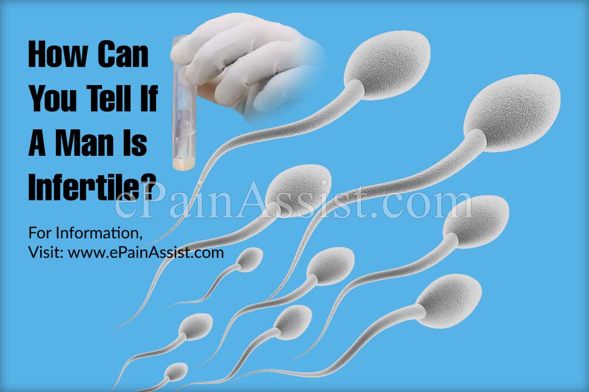 You are currently viewing Men can also be ‘infertile’ – Fulcrumy Health Tip