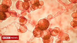 Read more about the article New danger!  Terrible White Fungus was found in the bodies of more than one patient in the country