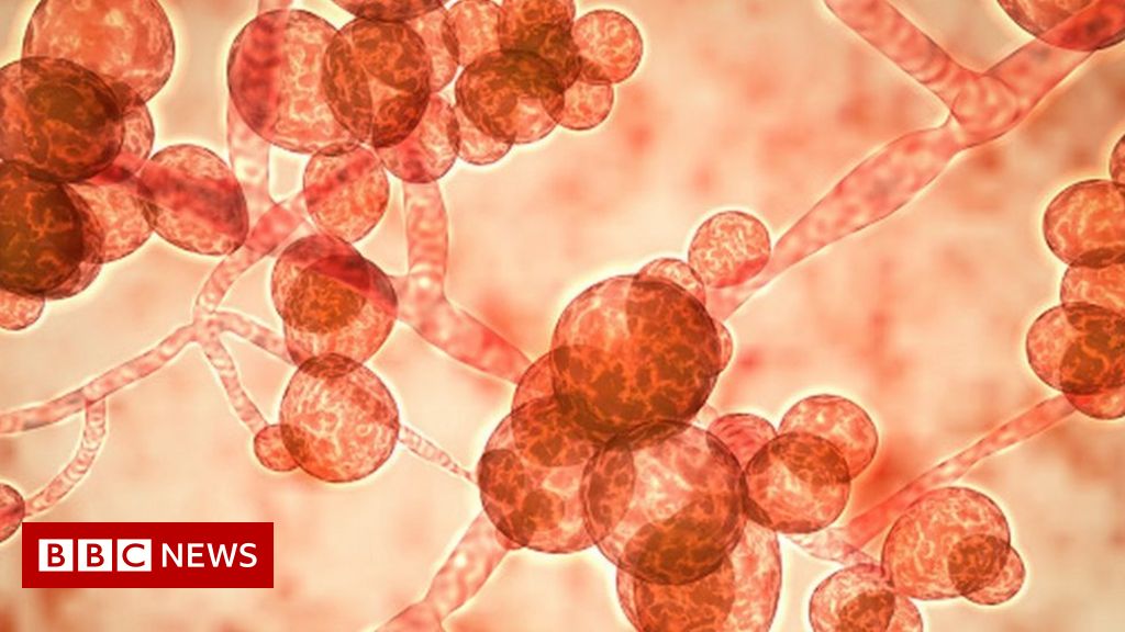 You are currently viewing New danger!  Terrible White Fungus was found in the bodies of more than one patient in the country