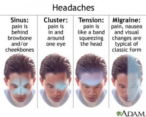 Read more about the article Occasional headaches?  If you follow all these ways, you will be released!