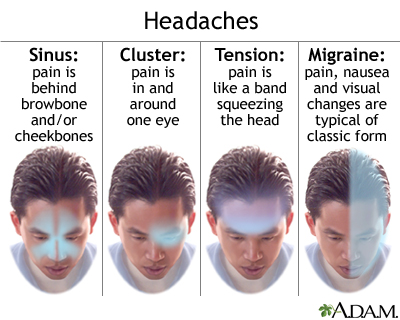 You are currently viewing Occasional headaches?  If you follow all these ways, you will be released!