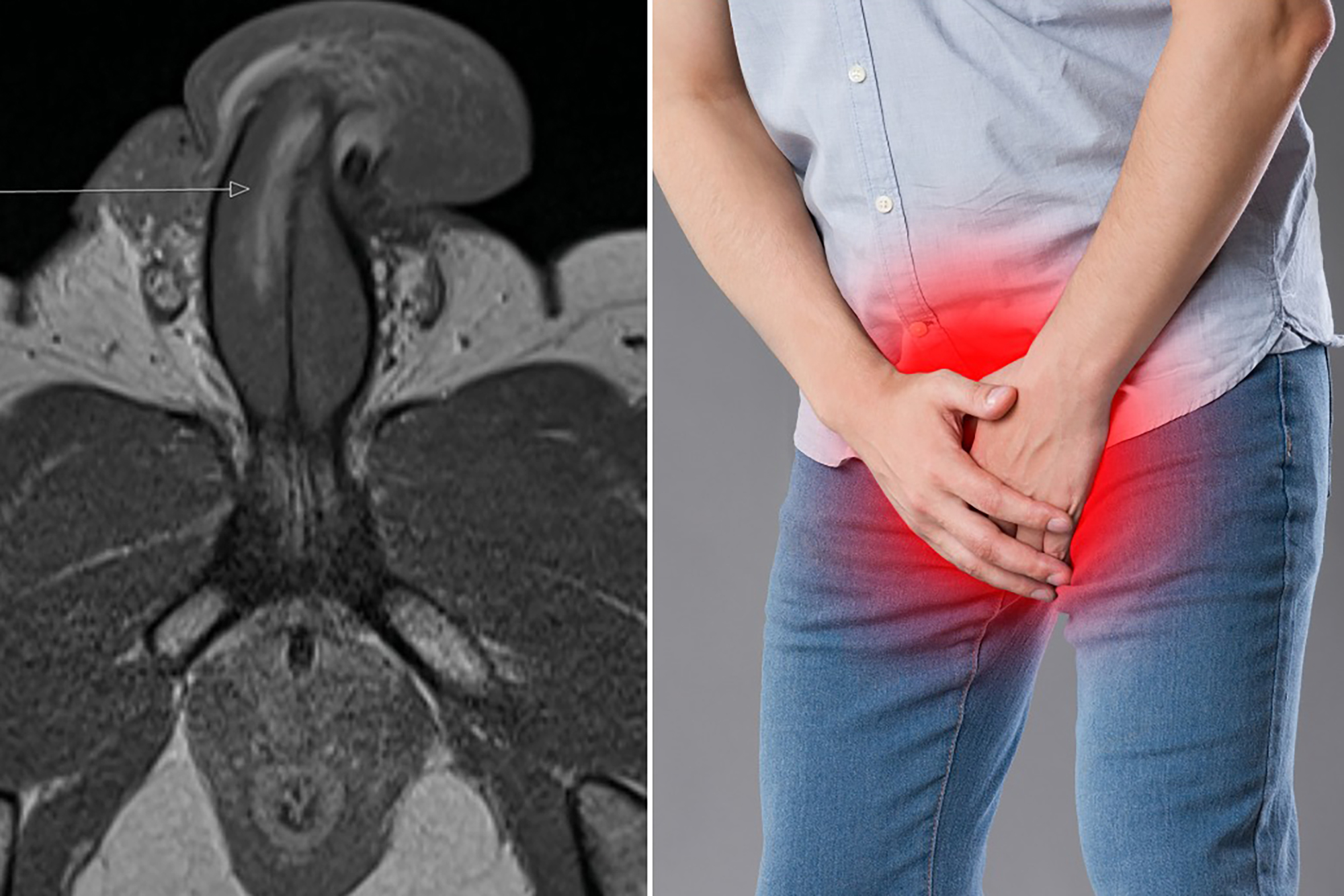 You are currently viewing Penis broke during sexual intercourse!  This is the first time in the history of medical science