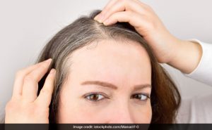 Read more about the article Premature graying hair – DesheBideshe – Fulcrumy Health Tip