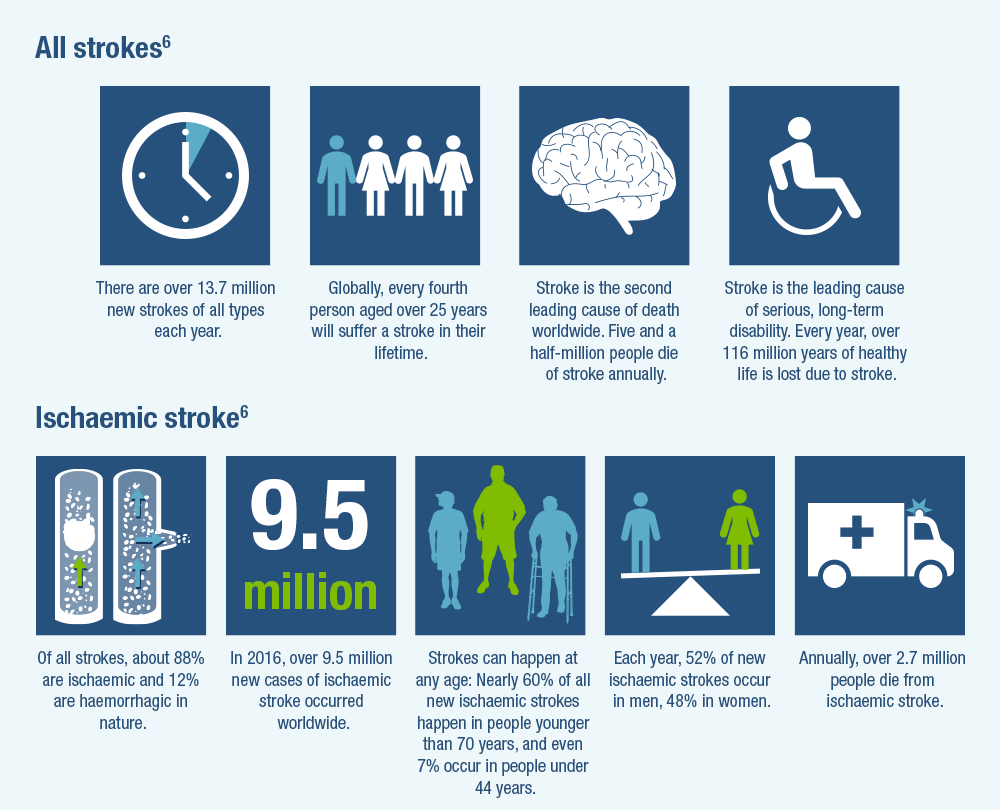 Read more about the article Stroke is the second leading cause of death in the country – Fulcrumy Health Tip