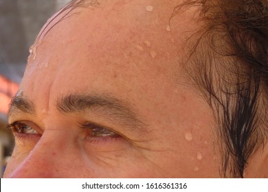Read more about the article Sweat on the head in the heat of the hair is falling?  Learn the solution – Fulcrumy Health Tip