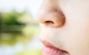 Read more about the article The skin around the nose is very rough?  Know the solution