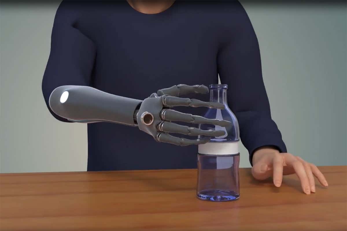 You are currently viewing The way the bionic hand changed a life …