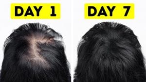 Read more about the article Want to thicken hair quickly?  7 easy tips to know – Fulcrumy Health Tip