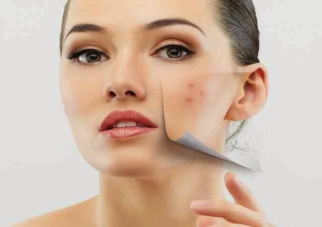 You are currently viewing Why is mechta, what to do to eliminate?  – Fulcrumy Health Tip